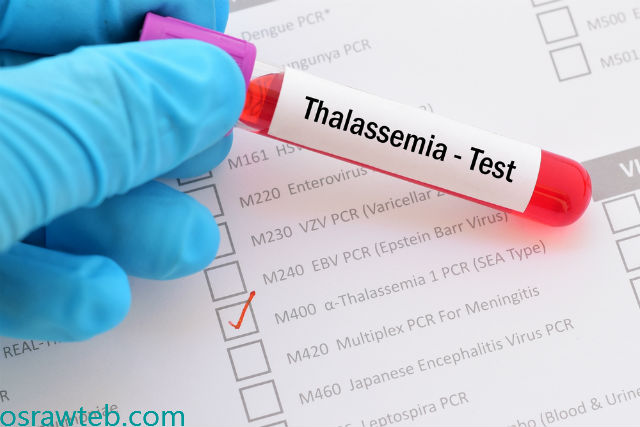 كيف يتم تشخيص الثلاسيميا