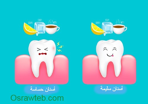 علاج حساسية الاسنان